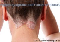 Trigger symptoms and Causes of Psoriasis