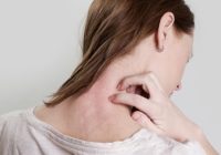 Know About the Psoriasis Complications and Treatments