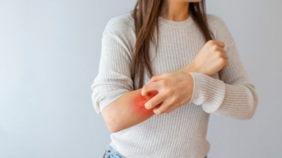 Homeopathy Tips to Get Quick Relief from Itchy Skin Allergies