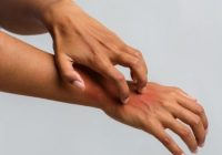 What Causes Psoriasis and What are Its Symptoms?