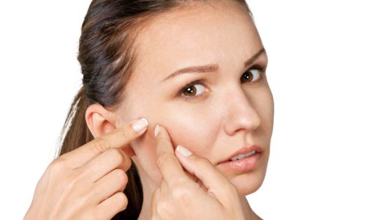 How to Prevent and Treat Acne Issues