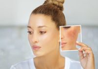 What can Cause Skin Hyperpigmentation and How to Treat It