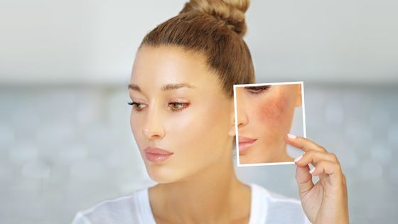 What can Cause Skin Hyperpigmentation and How to Treat It