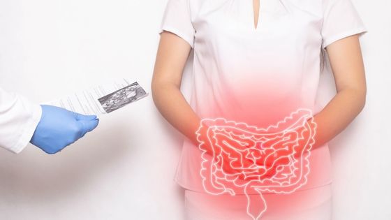 Psychological Disorders in Patients Suffering with Chronic Constipation